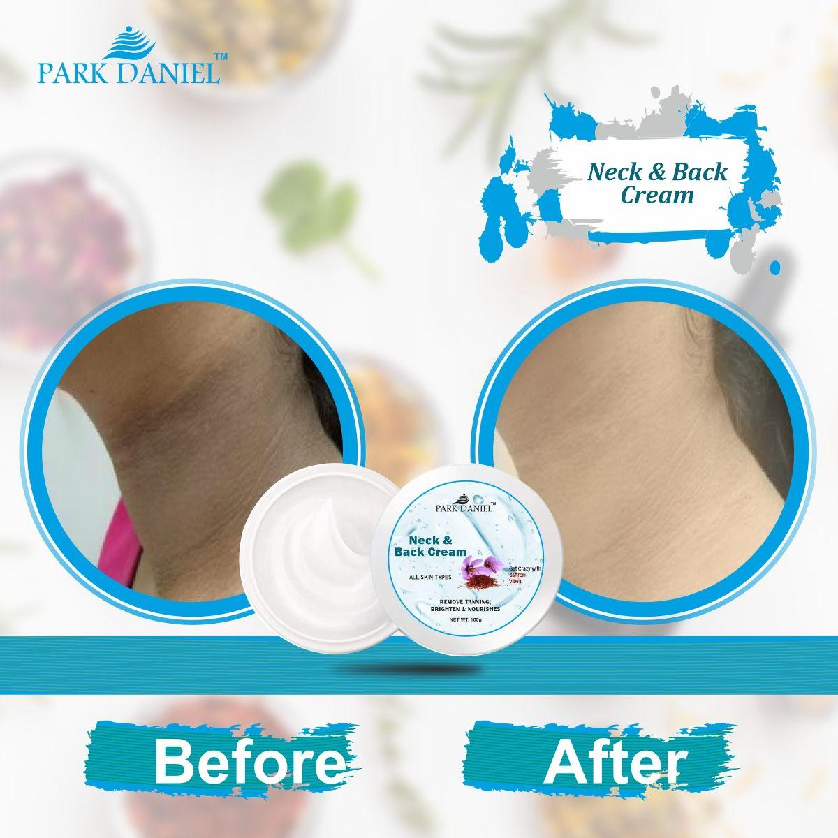 Park Daniel Neck and Back Whitening Cream - Dead Skin Cells Repair | Tan Removal Pack Pack of 4 of (100 grams)